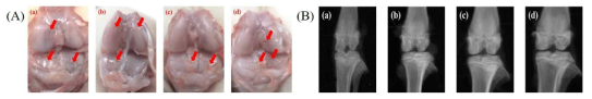 (A) 염증사이토카인 유도 후 육안관찰 (B) X-ray 결과