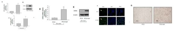 PC9-Gef 세포와 종양에서 AGR2의 과발현