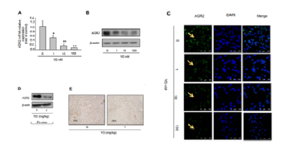 PC9-Gef 세포와 종양 조직에서 YD에 의한 AGR2 발현 억제