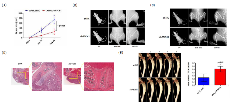마우스 다리에 shNC 세포와 shPTCH1 안정화세포를 주사하고 35일, 60일 후 종양 생성 여부(A), 35일 (B), 60일(C) 후 x-ray 촬영을 실시함. (D)35일 후 H&E 염색을 통한 형태 분석(D),미세전산화단층촬영을 실시하여 3D image를 만들어 비교 분석함(E)