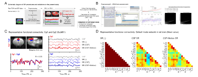 비임상 rs-fMRI 분석 파라미터 최적화 (A) 및 전처리 코드 확립 (B), 기능적 연결성 측정을 위한 데이터 전처리의 예시 (nuisance signal regression, C-D)
