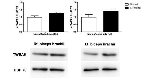 뇌성마비 동물모델 이두근 TWEAK 단백질량에 대한 정상대비 western blot 분석결과