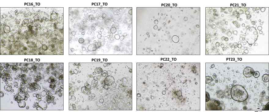 Representative images of human pancreatic cancer organoids. Scale bar, 40 μm