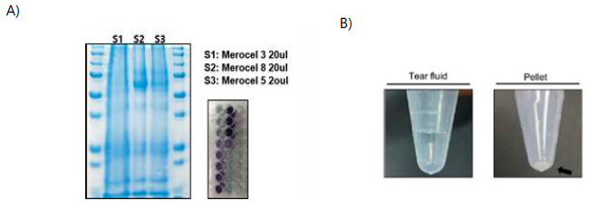 메로셀로 이용해 눈물 수집 후 엑소좀 분리