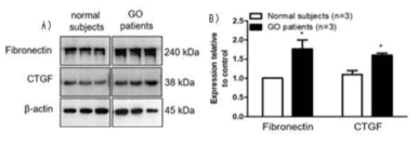 안병증 환자의 안와섬유모세포에서 fibronectin과 CTGF 발현확인