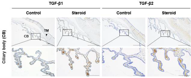 Rabbit model steroid 처리 후 ciliary body에서 TGF-β 증가 확인됨
