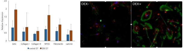 TM cell steroid 처리 후 gene expression 변화 양상과 TM cell에서의 actin과 fibronectin 증가 양상