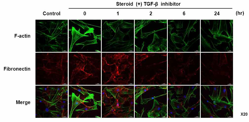 Human TM cell에 steroid 처리 후 recombinant protein을 이용하여 TGF-β inhibition을 시행한 결과 actin과 fibronectin의 발현 억제가 확인됨