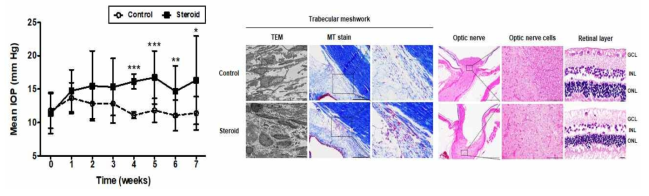 Rabbit glaucoma model. 대조군과 안압 차이가 확인되며 TM과 ON 구조의 변화가 관찰됨