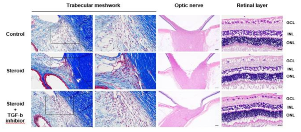 Masson-trichrome 염색을 통해 TGF-β inhibition에 의한 TM ECM의 구조적 변화 억제 확인 및 안압 변화에 따른 Optic nerve의 차이 확인