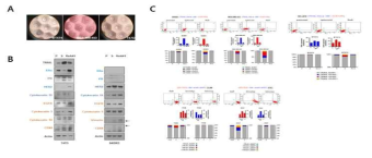 순환유방암세포 유래 전이암 구축 및 TRAIL, DcR1 단백질 발현 확인