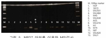 NR27 마커를 이용한 MSI검사