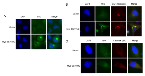 SERTM2 단백질은 골지체에 존재. A. SERTM2 단백질의 세포내 위치. myc-SERTM2를 HeLa에 발현시키고 면역형광염색법을 수행하여 발현위치를 관찰함. DNA는 DAPI, myc-SERTM2은 myc 항체를 이용하여 검출함. B. SERTM2와 GM130 colocalization. Vector 또는 myc-SERTM2 발현시킨 후 myc 항체, Golgi 마커 GM130 항체로 검출함. C. B와 동일조건의 세포에서 ER 마커 Calnexin 항체로 검출함