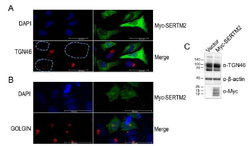 SERTM2 발현에 의한 TGN46 시그널 소실. A. HeLa 세포에 myc-SERTM2 transfection 시키고 myc 항체, TGN46 항체를 사용하여 면역형광염색을 수행함. TGN46 형광 시그널이 감소한 세포는 점선으로 표시함. B. 동일한 실험을 myc 항체, GOLGIN 항체를 사용함. C. Vector 또는 myc-SERTM2를 transfection 시킨 HeLa 세포의 추출액을 Immunoblot 수행함