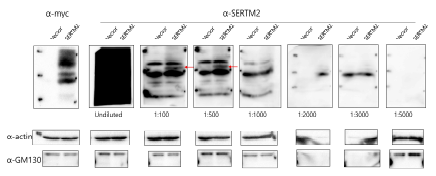 SERTM2 항체 테스트. myc-SERTM2 transfection 한 HeLa 세포 추출액을 SDS-PAGE 분리하고 rabbit-SERTM2 항체로 검출함. 항체 조건을 위해 여러 희석 농도에서 검출 시도함. 대조군으로 vector 발현한 추출액을 사용하였음. myc 항체를 이용하여 myc-SERTM2 발현을 확인하였으며 beta-actin 과 GM-130을 함께 검출함. Rabbit-SERTM2항체로 검출된 양성밴드는 빨간색 화살표로 표시함