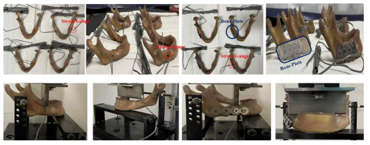 골 형상 모델과 시술 모델 간의 생체역학적 실험 결과