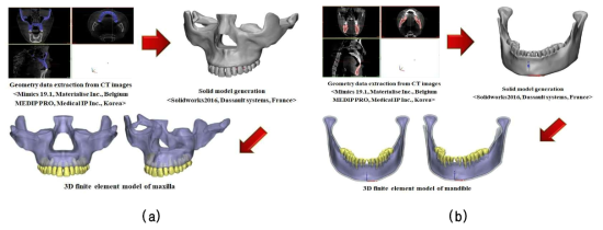 상악골 및 하악골의 3차원 유한요소모델 재건
