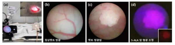 굴곡형 미세내시경 기반 소동물 방광암 명시야·형광 모니터링 시스템. (a) 굴곡형 미세 내시경의 방광 내부 측정 환경, (b) 정상 랫트의 방광 내부, (c) 랫트의 방광암 명시야 이미지 및 (d) 5-ALA 형광 이미지