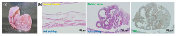 (a) 적출된 랫트 방광 내부 사진 및 (b) 정상·암 랫트 조직의 H/E 및 FECH 염색 이미지