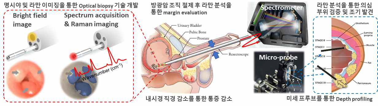 본 과제에서 제안하는 미세 내시경 기반 비표지 진단 시스템 개발을 통한 연구목표 달성 개요