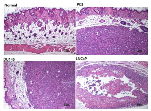 xeno graft 동물 모델 H&E staining 결과