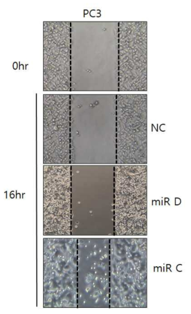 PC3 세포에서의 miRNA C, D 처리에 의한 cell migration assay 결과