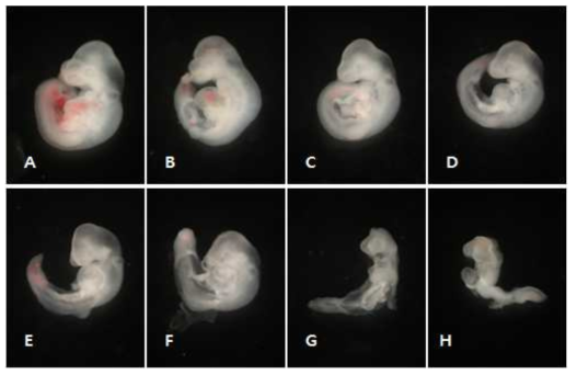 Representative teratogenic images in the mouse embryos exposed to various doses of nicotine. A) normal control. B) 0.06 mM nicotine. C) 0.15 mM nicotine. D) 0.6 mM nicotine. E) 0.8 mM nicotine. F) 0.9 mM nicotine. G) 1.0 mM nicotine. H) 1.2 mM nicotine