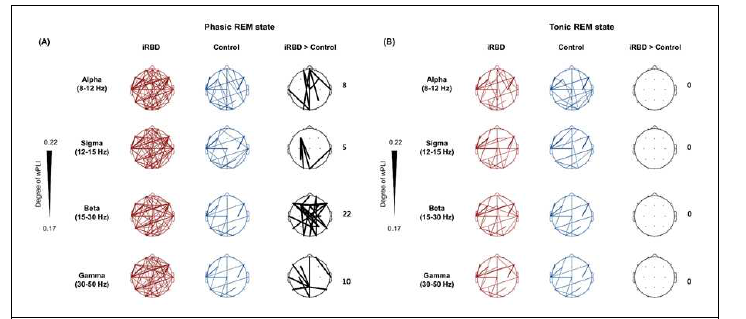 위상 및 긴장 렘수면 중 뇌 기능적 연결성 분석. (좌) 위상 렘수면 중 iRBD 환자군에서 기능적 연결성이 대조군에 비해서 유의하게 증가. (우) 긴장 렘수면에는 두 그룹간의 연결성에 차 이가 없음.