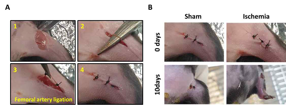 허혈성 동물모델 수술 과정 (A) 및 사지 손실 확인