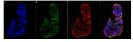 뇌 오가노이드 단기배양 분석 단기배양 (30일) 뇌 오가노이드의 초고해상 이미지 분석을 통한 신경 발달 확인. A: DAPI (Nuclei), B: Tuj1 (Neurons, neural marker), C: SOX2 (Neural stem cell marker), D: Merge. Scale bar = 200 ㎛