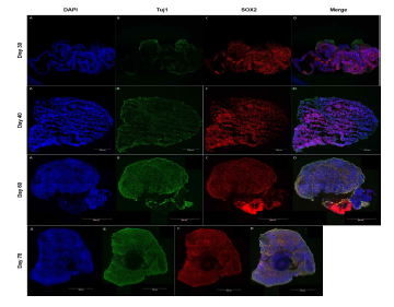 뇌 오가노이드 배양 기간별 발달 분석 뇌 오가노이드의 배양 기간 (30, 40, 60, 78일)에 따른 신경 분화 정도 확인. 초 고해상 이미지 분석을 통한 신경발달 특이마커 검출. A: DAPI (Nuclei, Blue), B: Tuj1 (Neuronal marker, Green), C: SOX2 (Neural stem cell marker, Red), D: Merge. Scale bar = 200㎛ (Day 30, 40), 500㎛ (Day 60, 78)