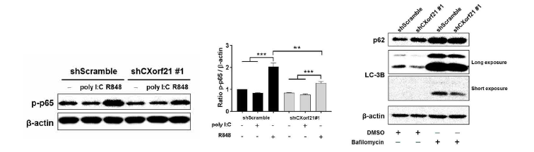 백혈병 세포주에서 Poly I:C, R848, Autophagy inhibitor에 따른 영향