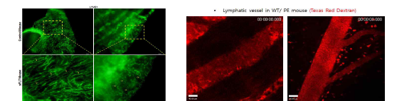 좌: 자궁벽내 림프관 투과성 조절 단백질 염색/ 우:림프관의 Texas Red dextran 흡수확인