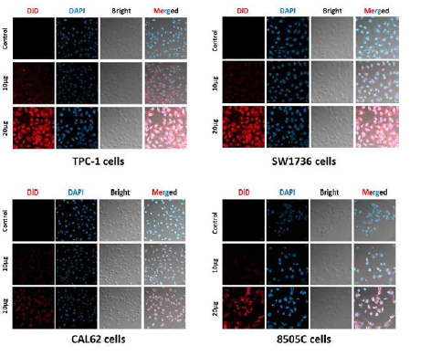 갑상선암세포 내 RBC-EVMsDiD internalization 확인