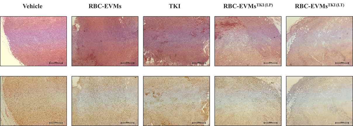 종양 조직 내 H&E staining (위), Ki67-Immunohistochemistry 수행