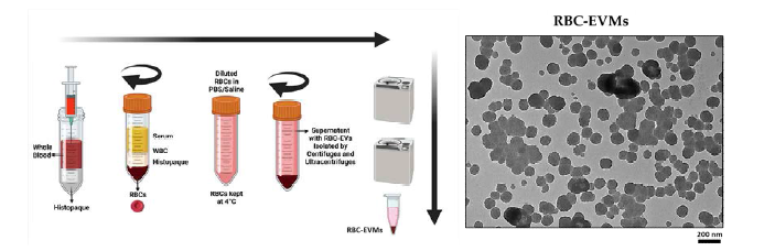 RBC-EVM 생산과 분리 및 전자현미경 사진 (EV 생산 illustration입니다. EVM생산으로 수정이 필요합니다.)