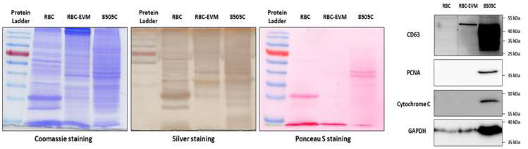 다양한 staining 기법을 이용한 단백 발현 확인 및 EV 특이 마커 발현 평가