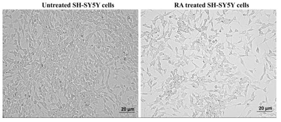 The morphology of SH-SY5Y cells before and after treatment of RA for cell differentiation