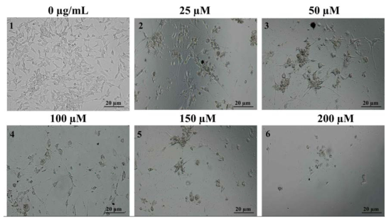 The dose-dependent treatemtn of β-amyloid on SH-SY5Y cells