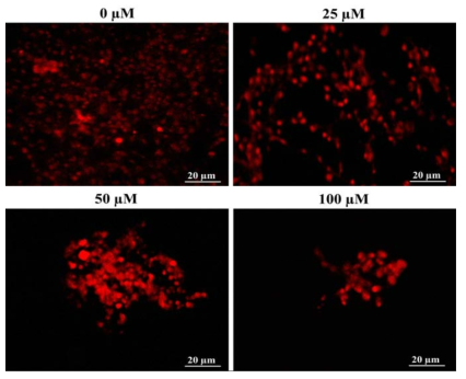 Propidium iodide (PI) staining analysis of β-amyloid treated SH-SY5Y cells