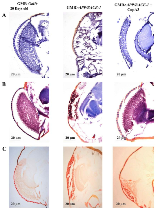 The histological analysis compound eye observation of with or without CopA3 treatment at different days of interval (A) Cason’s trichome staining, (B) violet staining (C) Congo red staining