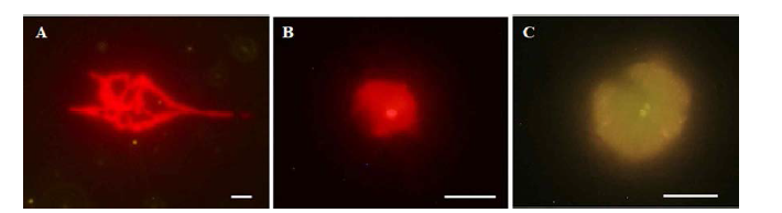 광영양 편모류가 광영양 세균 Synechococcus sp.를 포식한 장면. A: Triceratium kofoidii, B: Tetraselmis sp., C: Heterosiagma akashiwo (크기 : 10㎛)