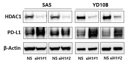 PD-L1 발현 구강암세포주에서 HDAC1 siRNA 처리에 의한 PD-L1 발현 변화. NS: Non-Spicific siRNA; siH1#1: HDAC1 siRNA #1; siH1#2: HDAC1 siRNA #2.