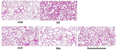 distribution of Innate lymphoid cell 2 (ILC2) in mouse lung