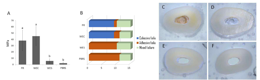 (A) Push-out bond strength 실험 결과. (B) Failure mode 결과. (C-F) 각 군의 대표적인 입체현미경 사진. (C) ProRoot(PR), (D) White Endocem(WEC), (E) White Endoseal(WES), (F) Pozzolan-based root canal sealer(PBRS)