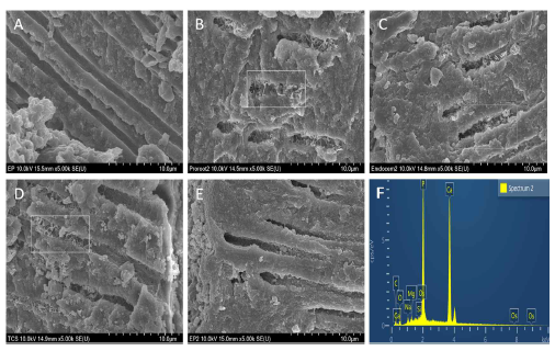 Intratubular biomineralization degree observed through SEM (A) control, (B) PR, (C) WEC, (D) WES and (E) PBRS. (F) EDS analysis of crystallization seeds