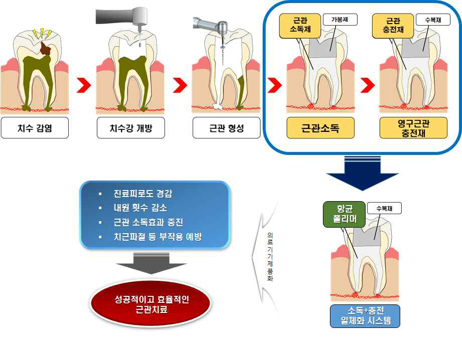 근관치료 과정 및 개발하려는 시스템의 개념도. 일반적으로 근관소독과 근관충전 과정이 독립적으로 수행되나 새롭게 개발하려는 개념은 두 과정이 하나로 통합된다