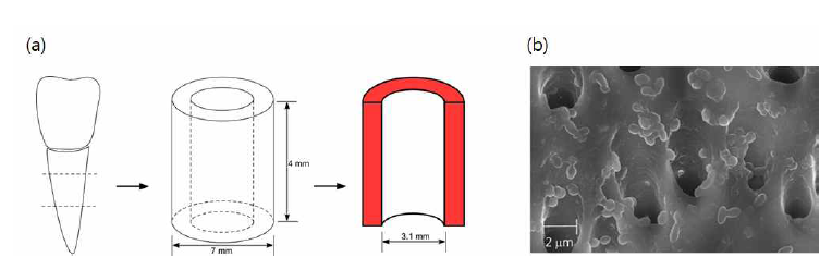 (a) 우치를 이용한 표준화 치근관 재현 모델. (b) 우치 치근관 내면에 형성된 바이오필름을 SEM으로 관찰한 결과