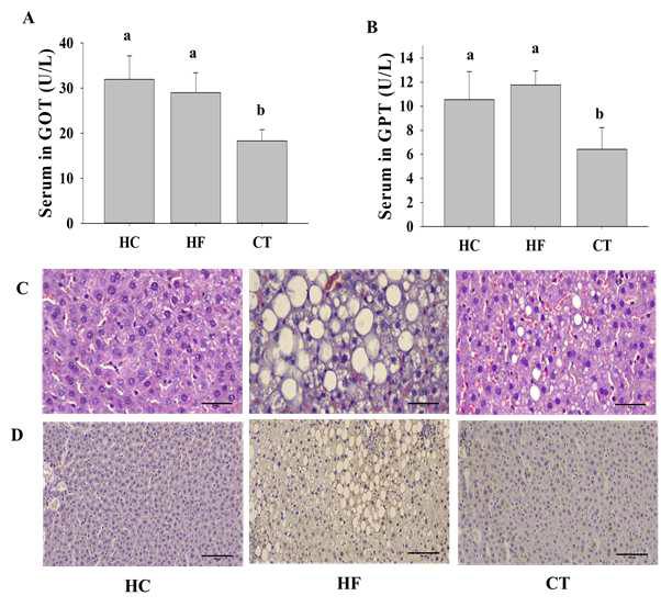 Effects of CT on liver function in HF diet-fed rats. (A) GOT levels. (B) GPT levels. (C) Hematoxylin and eosin (H HF, 60% fructose diet; CT, 60% fructose diet with C. trichotomum leaf extract (500 mg/kg of body weight)