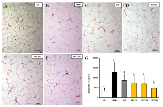 Effect of PRF on the size of epididymal adipocytes in HFD induced obese mice. The sections of the epididymal fat tissues of ND (A), HFD (B), OR (C), PRE 50 (D), PRE 100 (E), and PRE 200 (F) were stained with H HFD, high-fat diet; OR, HFD + 15.6 mg of orlistat; PRF 50 and PRE 100 and PRE 200, HFD + 50, 100, 200 mg of PRF, respectively. The results were expressed the means ± S.D (n=7). The values with different letters (a, b, c and d) are significantly different (p<0.05) from each other by one-way ANOVA and Duncan’s multiple range test